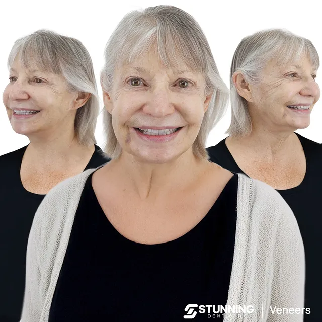 Smile Makeover, USA - photo 2