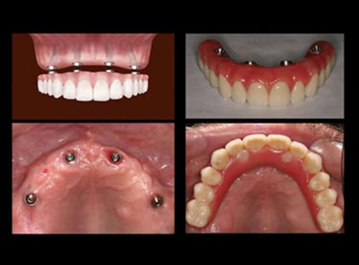 Related Treatments